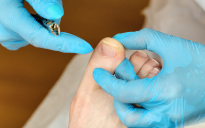 The Dangers of Cutting Cuticles: A Closer Look, Especially in Florida – Insights from Doug Schoon